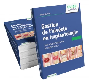 Gestion de l'alvéole en implantologie Dr Pierre Cherfane