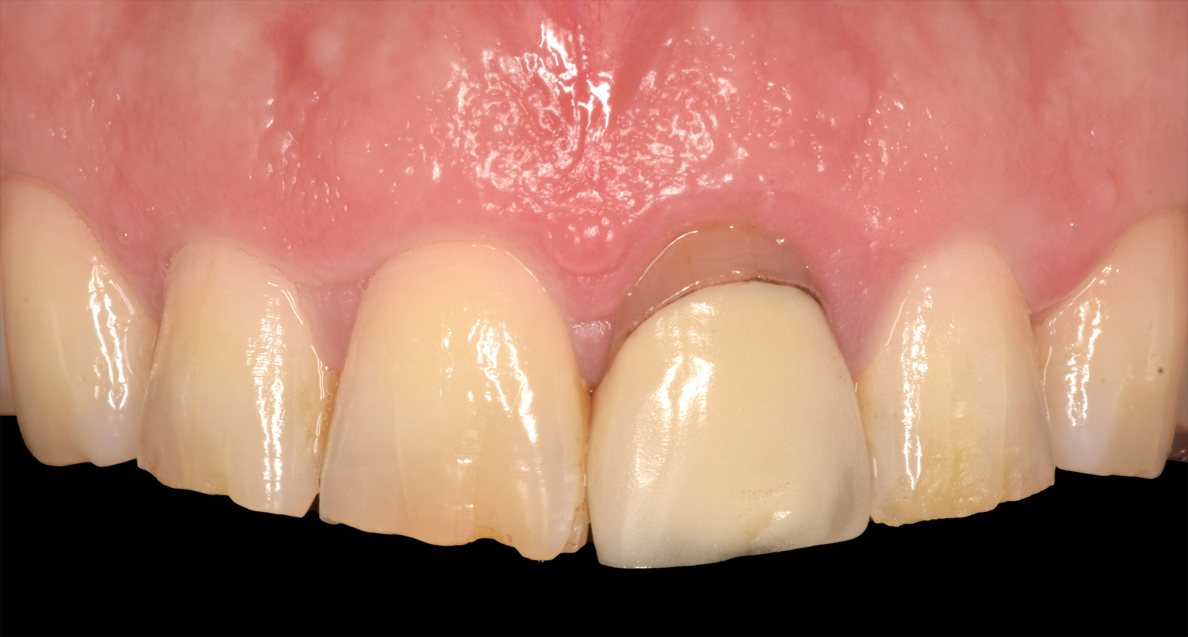 La place de la parodontologie en omnipratique
